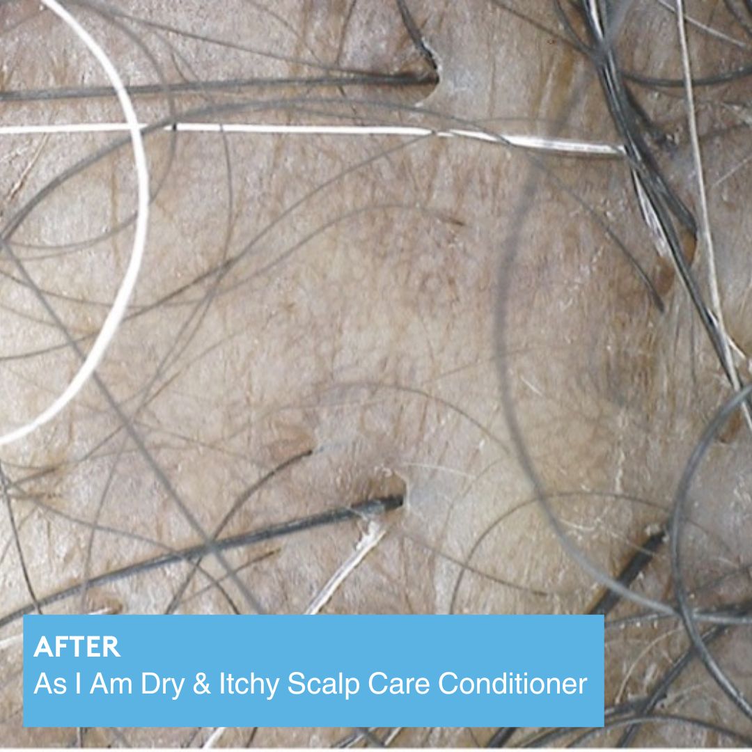 Dry & Itchy Scalp Care Conditioner