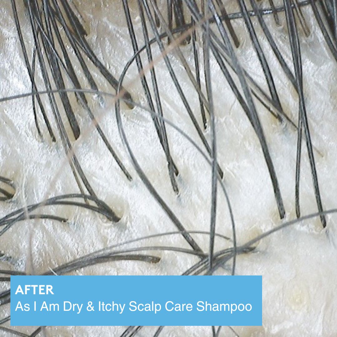 dry & itchy scalp care shampoo