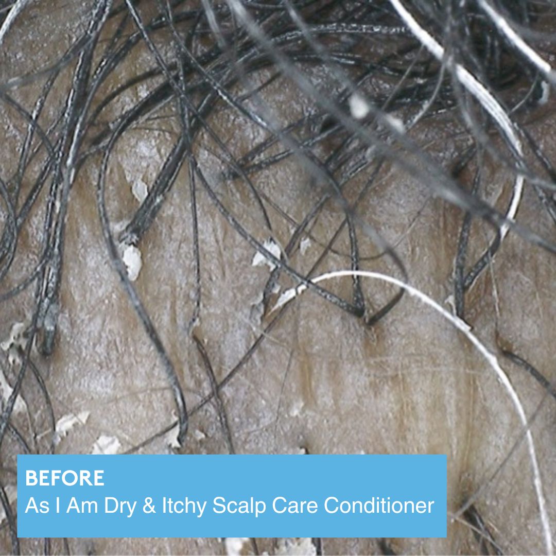 dry & itchy scalp care conditioner