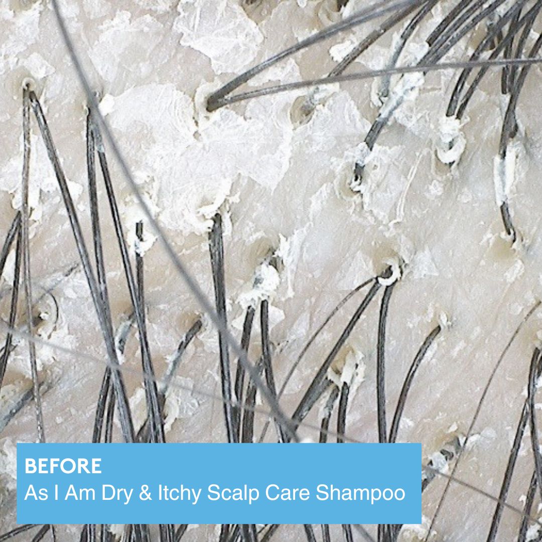 dry & itchy scalp care shampoo