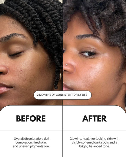 Sérum de vitamina C para el rostro