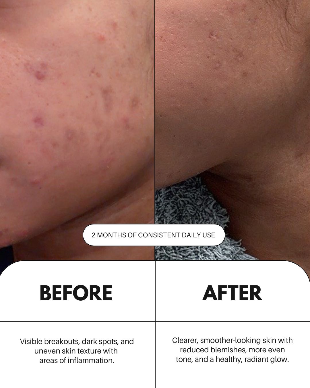 سيروم فيتامين C للوجه