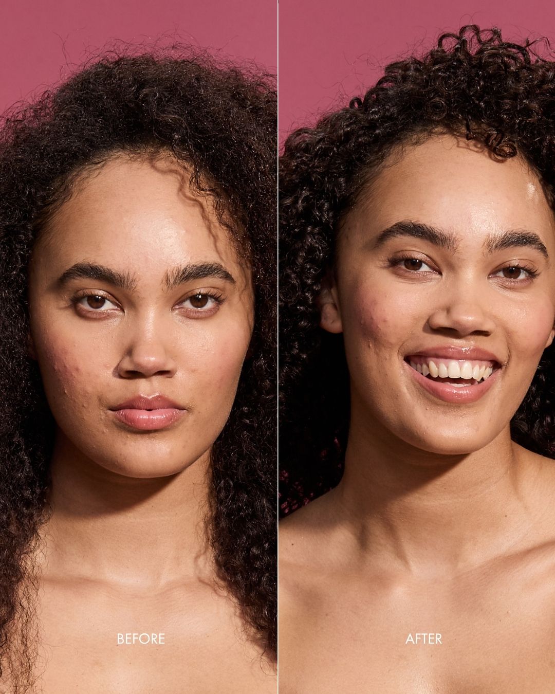Before and after comparison of a woman after using onion conditioner
