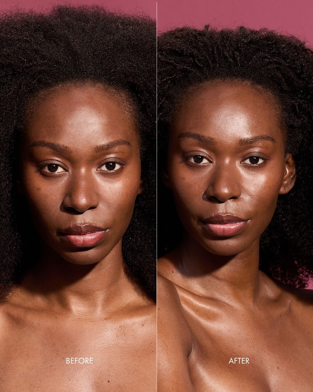 Before and after comparison of a woman after using onion leave-in conditioner