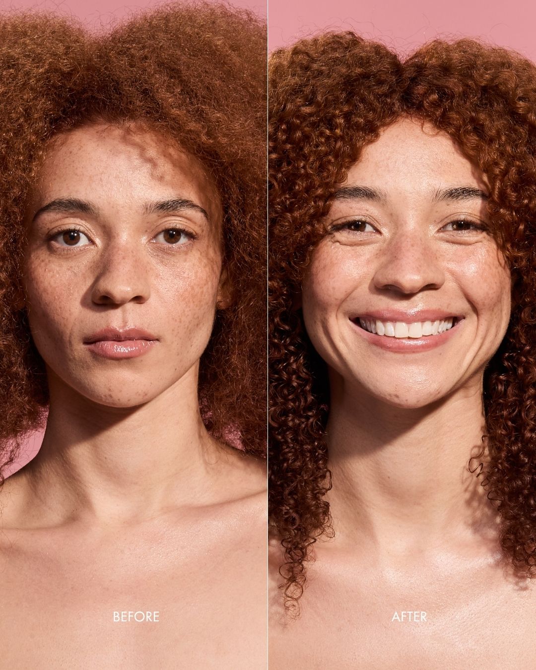 Before and after comparison of a woman with curly hair using onion shampoo