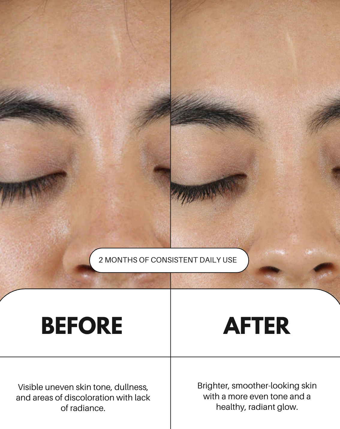 Sérum de vitamina C para el rostro