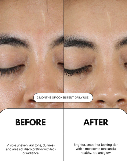 Sérum de vitamina C para el rostro